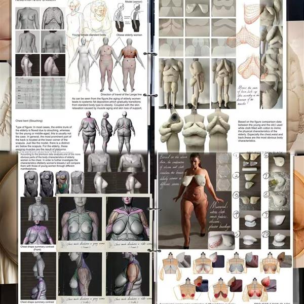 《皮肤松懈》（skin slack）